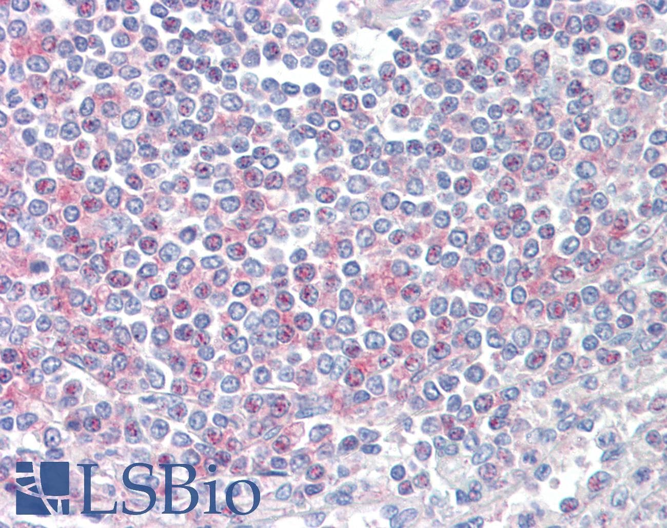 IHC-plus™ CD2BP2 Antibody (aa2-14)