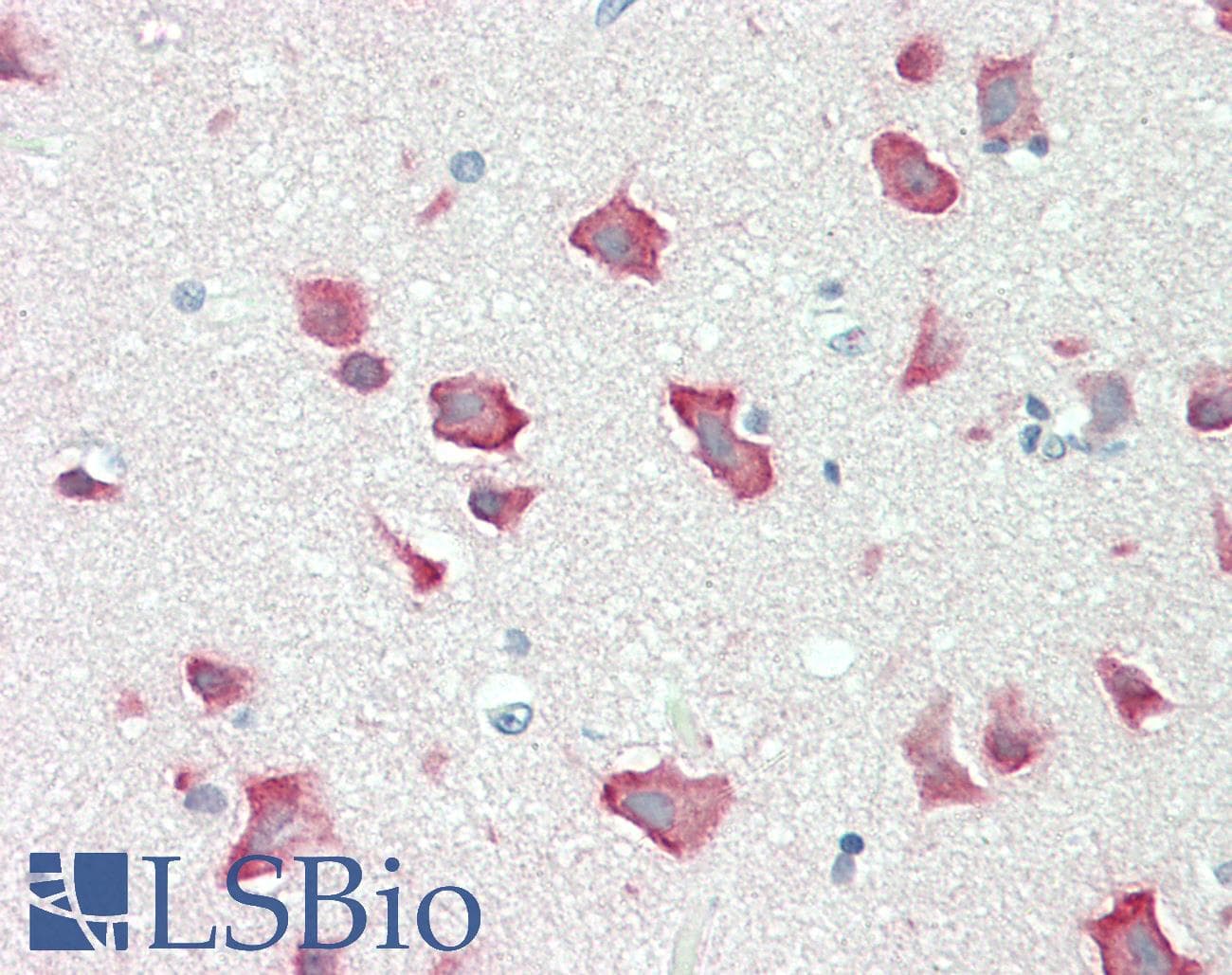 IHC-plus™ RPS6KB2 / S6K2 Antibody (aa300-350)