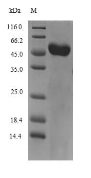 Mouse GC / Vitamin D-Binding Protein (Recombinant 6His, N-terminus)