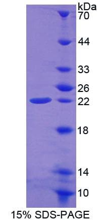 Mouse FTH1 / Ferritin Heavy Chain Protein (Recombinant His, N-Terminal)