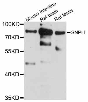 Polyclonal Rabbit anti-Human SNPH Antibody (IHC, WB)
