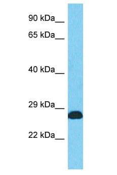 Polyclonal Rabbit anti-Human PCNA Antibody (aa67-116, WB)