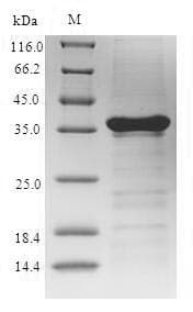 Sarcoplasmic calcium binding protein (Penaeus monodon) (Recombinant 6His-SUMO, N-terminus)