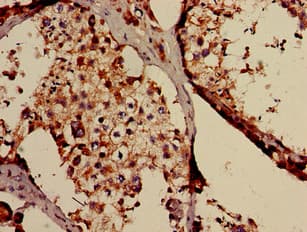 TAF6L Antibody