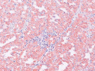 A2M / Alpha-2-Macroglobulin Antibody (clone PSA24)