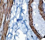 Monoclonal Mouse anti-Human ACTA2 / Smooth Muscle Actin Antibody (IHC)