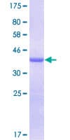 Human LGALS1 / Galectin 1 Protein (Recombinant GST)