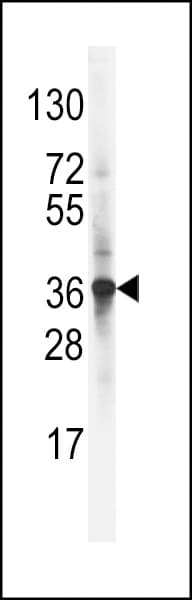 Polyclonal Rabbit anti-Human ARH / LDLRAP1 Antibody (aa277-306, IHC, WB)