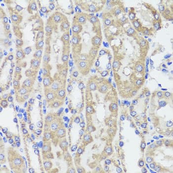 KLK3 / PSA Antibody