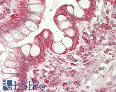 IHC-plus™ Polyclonal Rabbit anti-Human P4HA1 Antibody (IHC, WB)