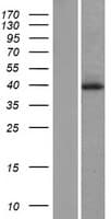 Human DUSP1 / MKP1 Protein (Over-Expression Lysate Myc-DDK (Flag))