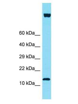 IQCF6 Antibody (aa72-121)