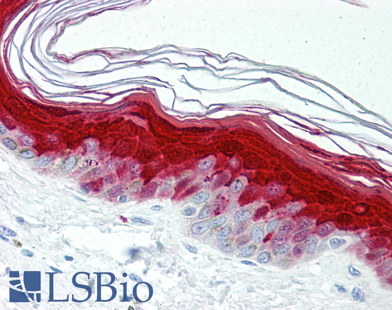 IHC-plus™ S100A7 / Psoriasin Antibody (clone 47C1068, Azide-free)