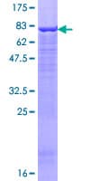 Human UBR2 Protein (Recombinant GST)
