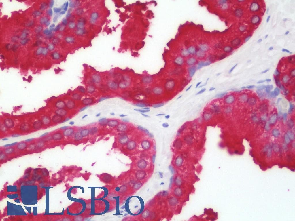 PathPlus™ ST6GAL1 / CD75 Antibody (aa178-206)