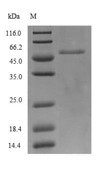 Reston Ebolavirus Nucleocapsid Protein (Recombinant 6His-SUMO, N-terminus)
