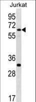 SMARCD1 / BAF60A Antibody (aa431-459)