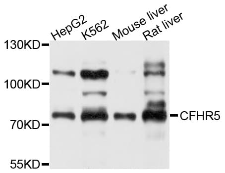 Polyclonal Rabbit anti-Human CFHR5 Antibody (WB)