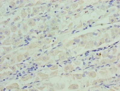 Polyclonal Rabbit anti-Human IGFBP1 Antibody (WB)