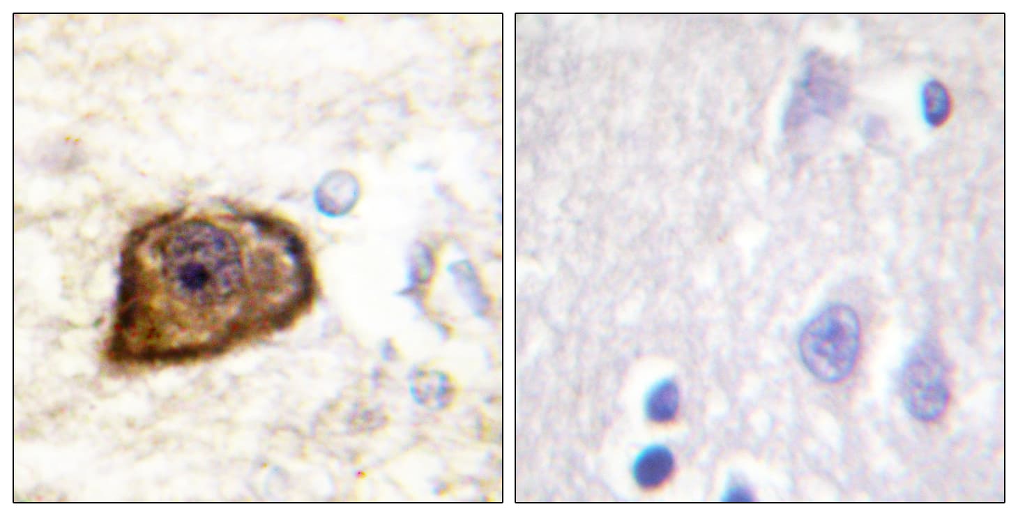 PDGFRB / PDGFR Beta Antibody (phospho-Tyr1021)