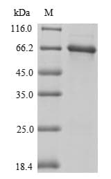Mouse GC / Vitamin D-Binding Protein (Recombinant 6His-SUMO, N-terminus)