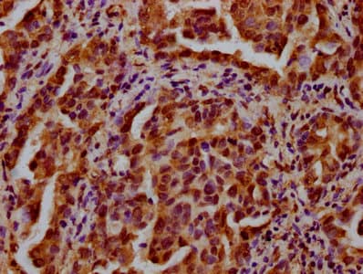 HIST1H3A Antibody