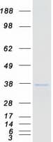 Human TFIIB Protein (Recombinant Myc-DDK (Flag))