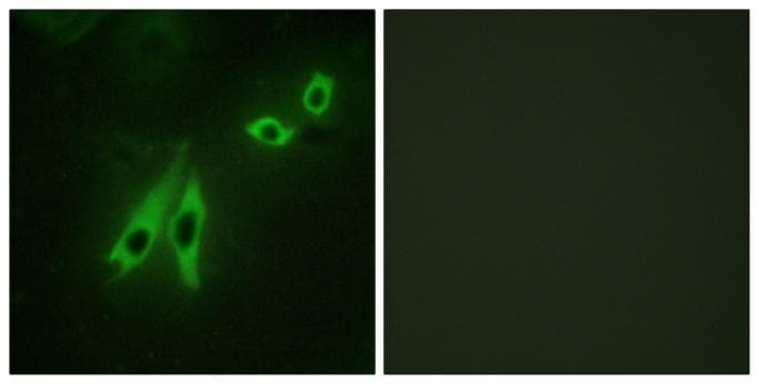 AKAP110 / AKAP3 Antibody