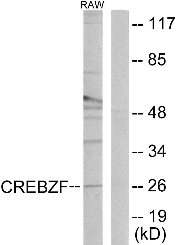 Polyclonal Rabbit anti-Human CREBZF / Zhangfei Antibody (IF, WB)