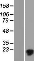 MMGT1 Protein (Over-Expression Lysate Myc-DDK (Flag))