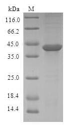 Human ASCC3 Protein (Recombinant GST, N-terminus)