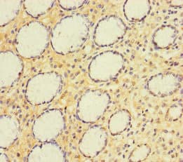 Polyclonal Rabbit anti-Human Alpha4GnT / A4GNT Antibody
