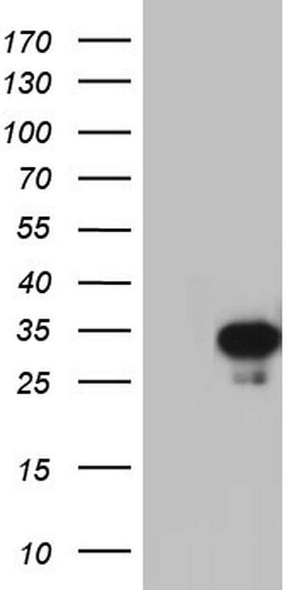 C14orf166 Antibody (clone OTI3F4)
