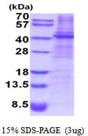 Human DCN / Decorin Protein (Recombinant His)