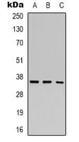 CHF1 / HEY2 Antibody (Internal)