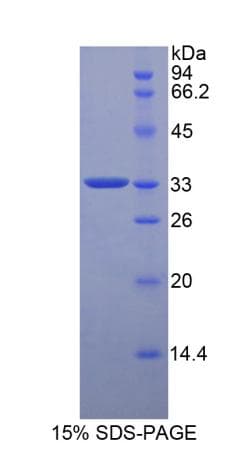 Mouse HP / Haptoglobin Protein (Recombinant His-T7)