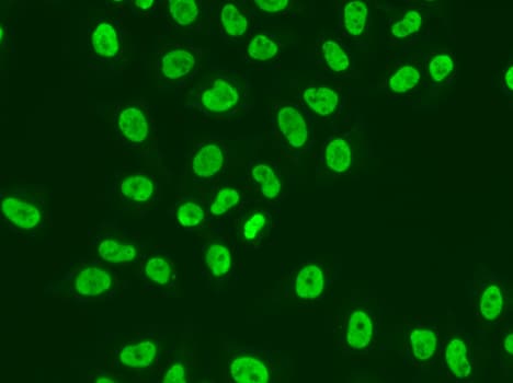 Polyclonal Rabbit anti-Human MSH6 Antibody (IHC, IF, WB)