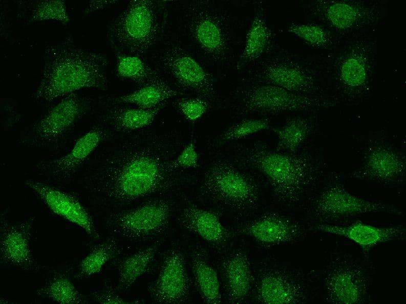 Polyclonal Rabbit anti-Human E2F4 Antibody (IF, WB)