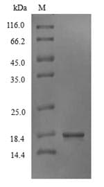 Woodchuck IFN Gamma / Interferon Gamma Protein (Recombinant 6His, N-terminus)