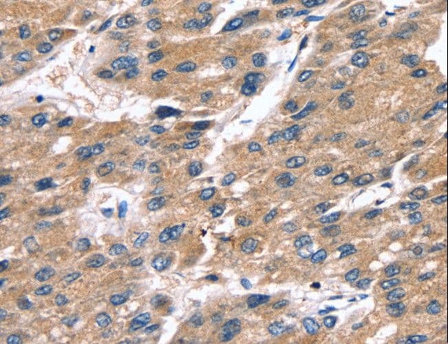 IHC-plus™ Polyclonal Rabbit anti-Human SRGN / Serglycin Antibody (IHC)