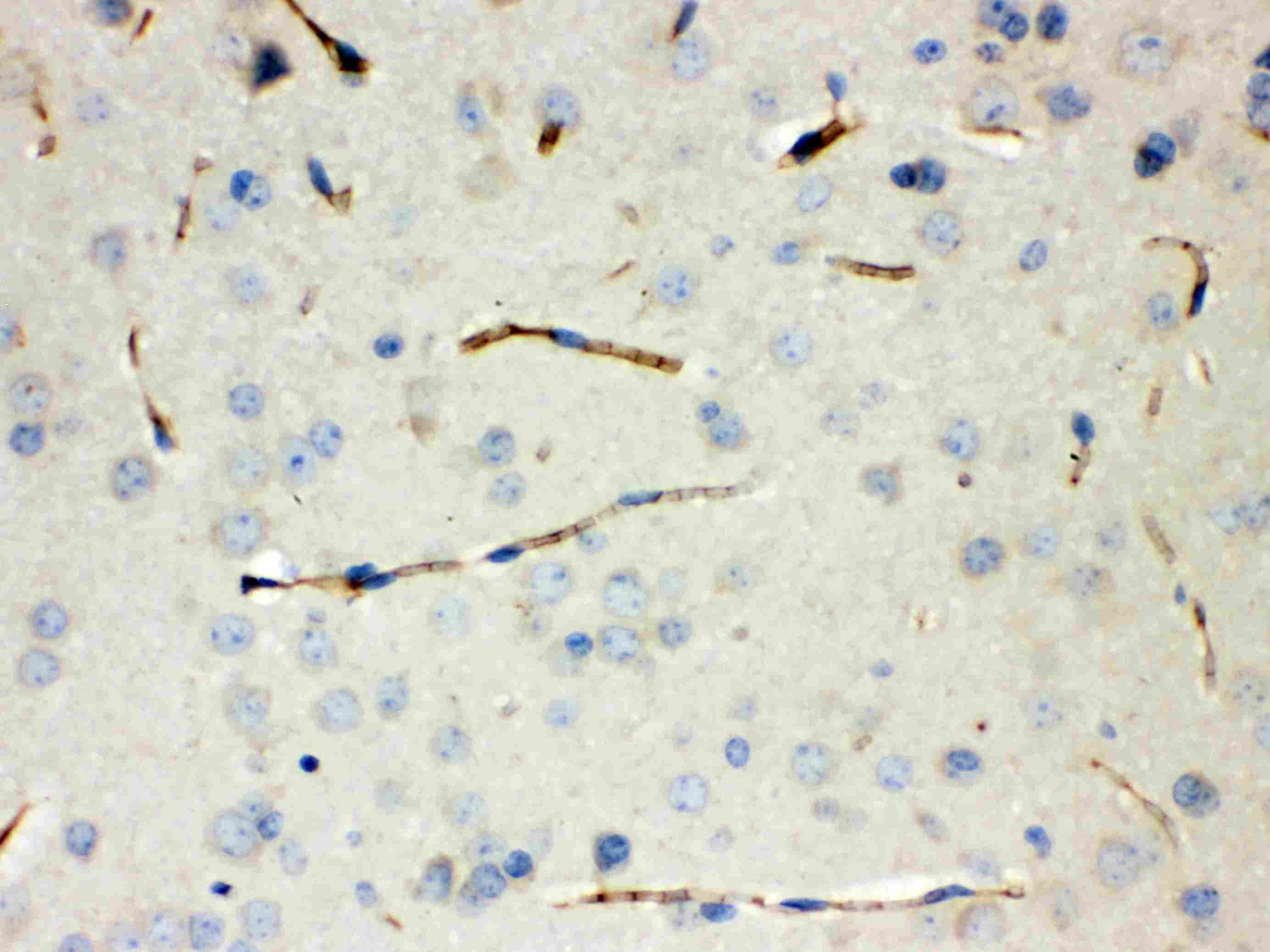 CALCA Antibody