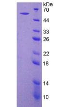 Rat CD39 Protein (Recombinant His-GST)