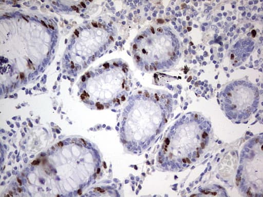 MKI67 / Ki67 Antibody (aa1160-1493, clone OTI8G3)