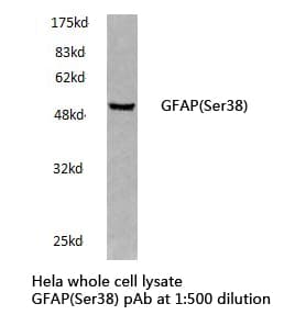 GFAP Antibody (Ser38)