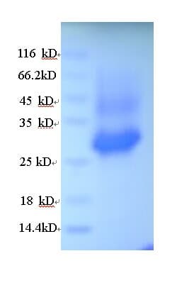 Human HNE / Neutrophil Elastase Protein (Recombinant 6His, N-terminus)