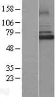 Human IRAK3 / IRAKM / IRAK-M Protein (Over-Expression Lysate Myc-DDK (Flag))