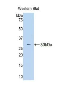 CSF1R / CD115 / FMS Antibody (aa639-868)