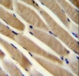 TRIM7 Antibody (aa67-95)