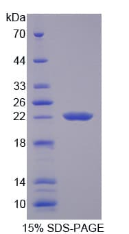 Rat TRPM7 Protein (Recombinant His-T7)