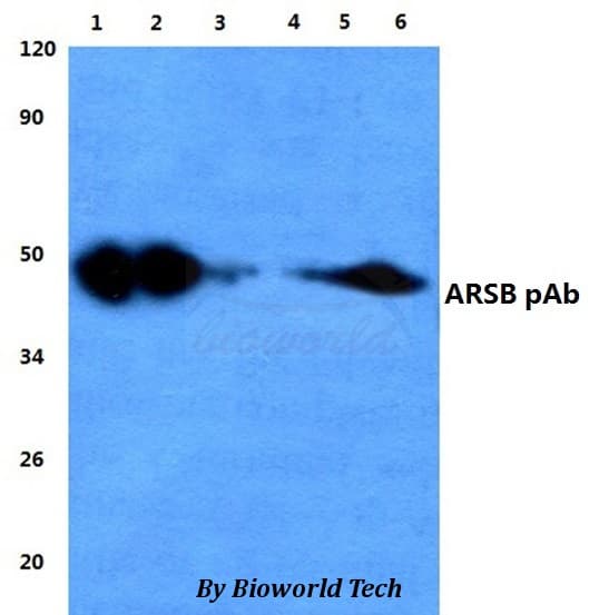 ARSB / Arylsulfatase B Antibody